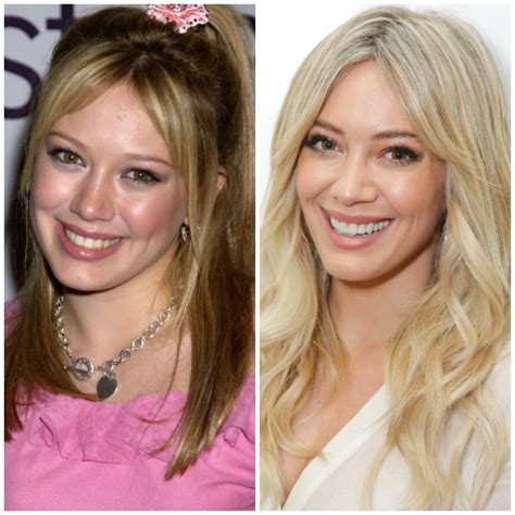 hillary duff plastic surgery|The Truth Behind Hilary Duff’s Plastic Surgery Rumors